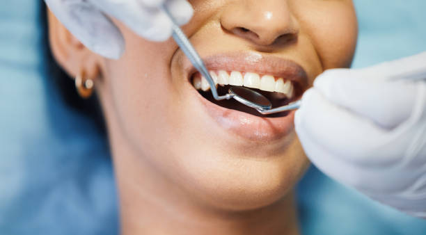 Best Emergency Dental Care for Abscessed Tooth in Gaylord, MI